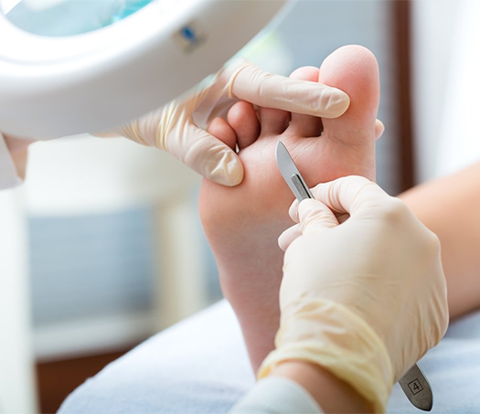 Diabetic Foot Treatment in Kolathur