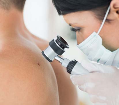 Dermoid Cyst Surgery in Kolathur