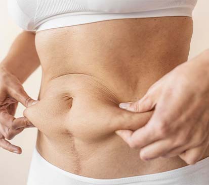 Lipoma Surgery in Kolathur