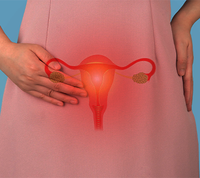 Ovarian Cyst Treatment Cost in Kolathur